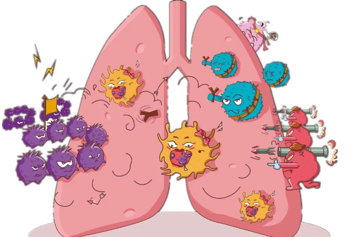 6次NK细胞联合治疗后，非小细胞肺癌患者的症状得到了明显改善