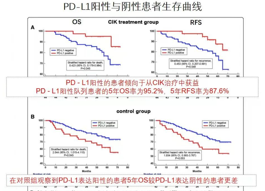 研究结果显示：CIK细胞辅助治疗术后乳腺癌患者，5年生存率高达95.2%