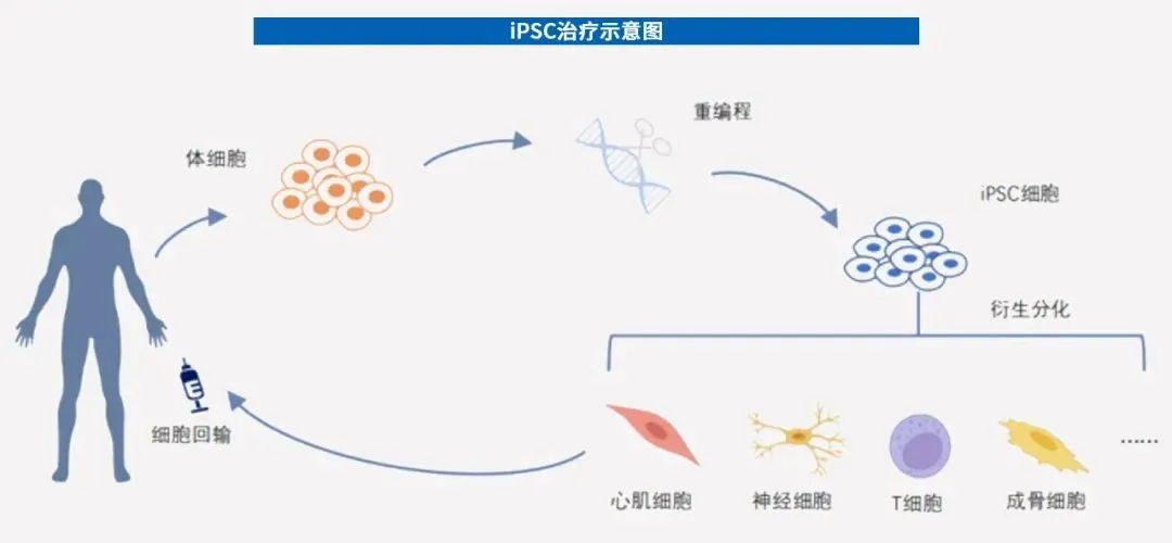 细胞治疗时代来临，诱导多能干细胞（iPSC）或成最优解！