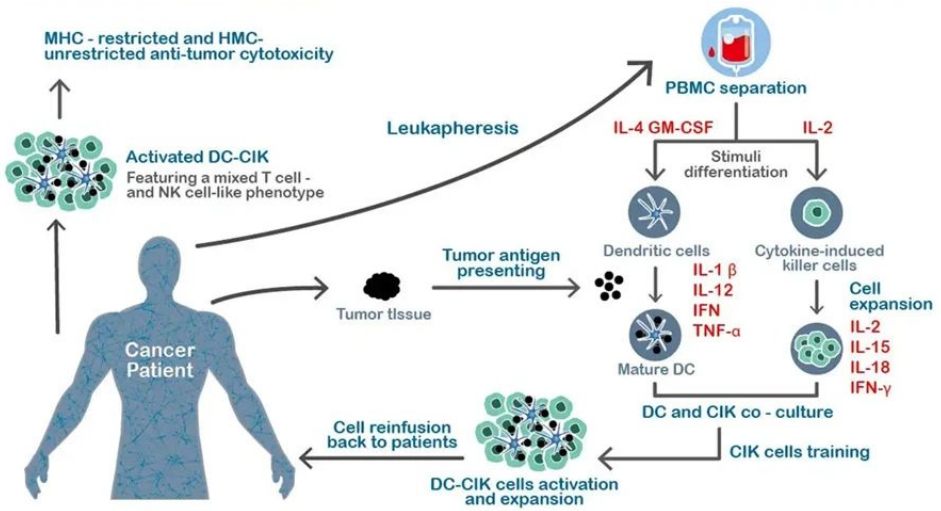 被誉为“细胞导弹”的CIK免疫细胞疗法到底有什么特殊的作用