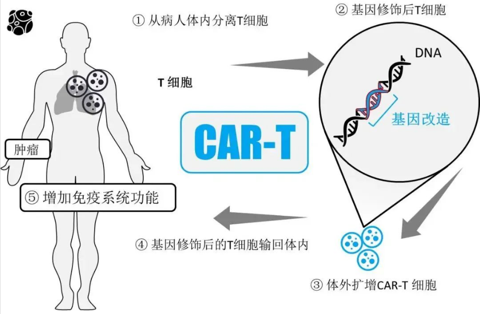 血液恶性肿瘤免疫治疗：CAR-T免疫疗法