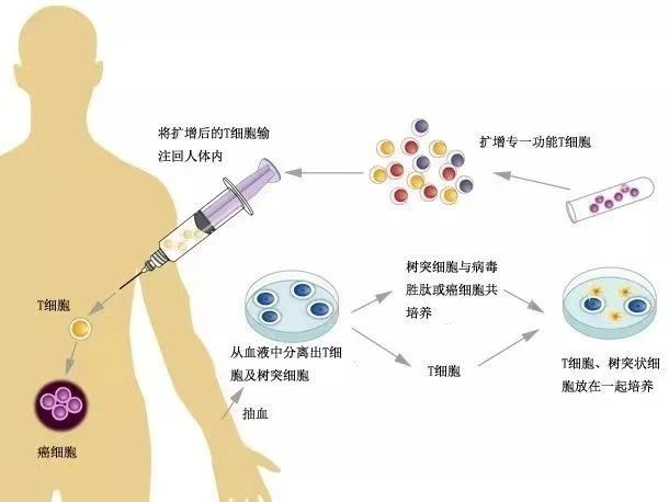 细胞抗癌四法宝：NK、CIK、DC、CTL都有哪些区别呢？