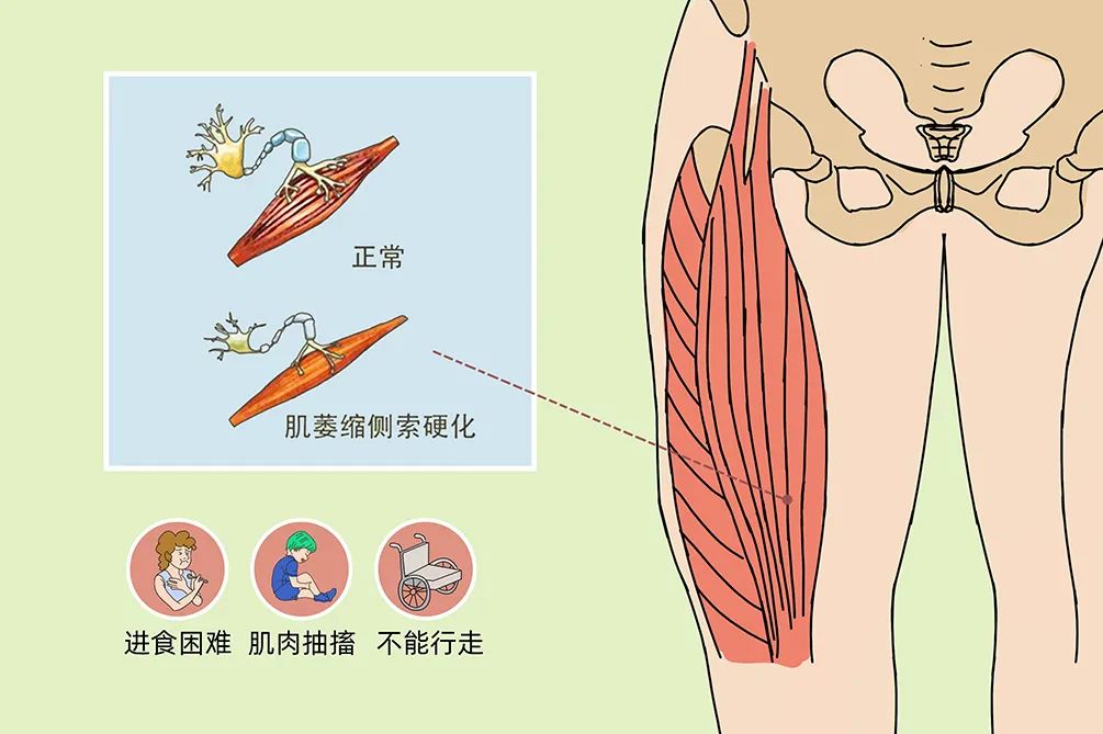 一文了解神经干细胞的稀缺性和重要性