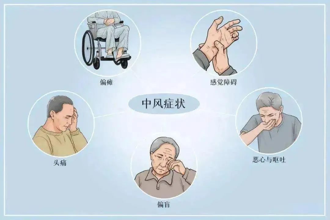干细胞修复脑卒中后神经损伤的临床研究