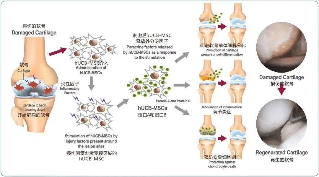 膝关节病症治疗的法宝：干细胞修复膝关节损伤，促进软骨再生！