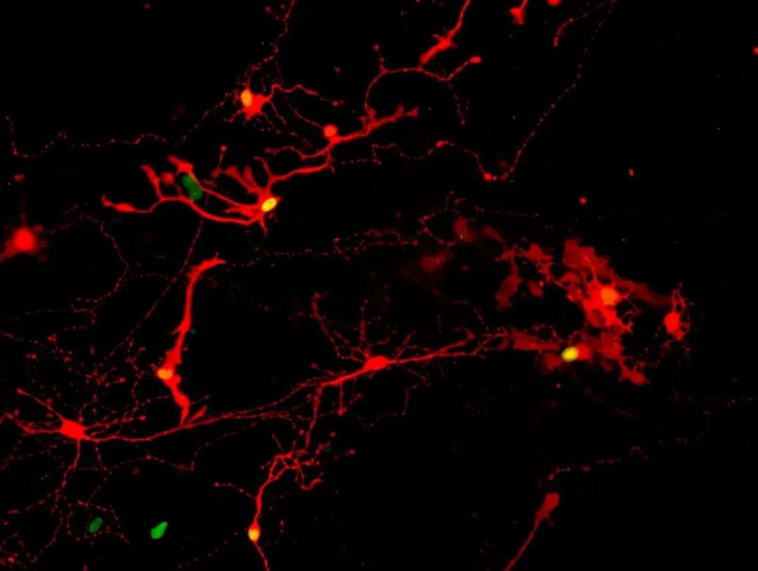 诱导多能干细胞iPSC衍生视网膜“类器官”真正实现突触链接挽救失明