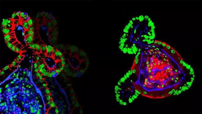 诱导多能干细胞iPSC衍生视网膜“类器官”真正实现突触链接挽救失明