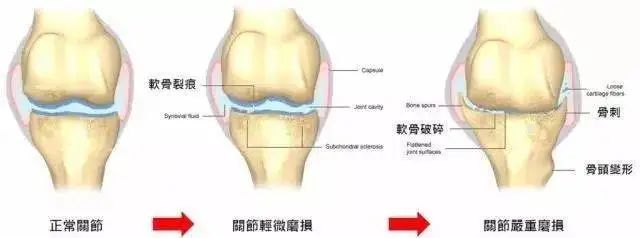 盘点通过干细胞疗法治愈的那些疾病，以及真实案例！